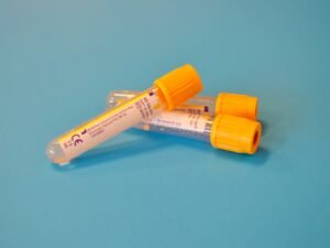 TRT Norge — Blodprøver for testosteron: Hva du trenger å vite for testing