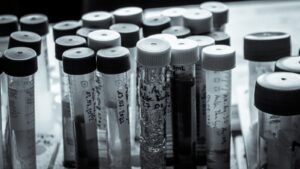 Hormonproever i laboratorium - prolaktin og menns helse